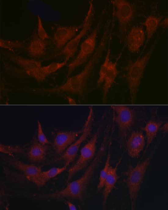 Immunocytochemistry/ Immunofluorescence MBP-1 Antibody - Azide and BSA Free