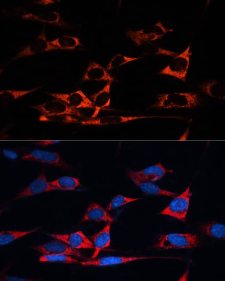 Immunocytochemistry/ Immunofluorescence: MAP1B Antibody - BSA Free [NBP3-04801] - Immunofluorescence analysis of NIH/3T3 cells using MAP1B antibody (A3305) at dilution of 1:100. Blue: DAPI for nuclear staining.