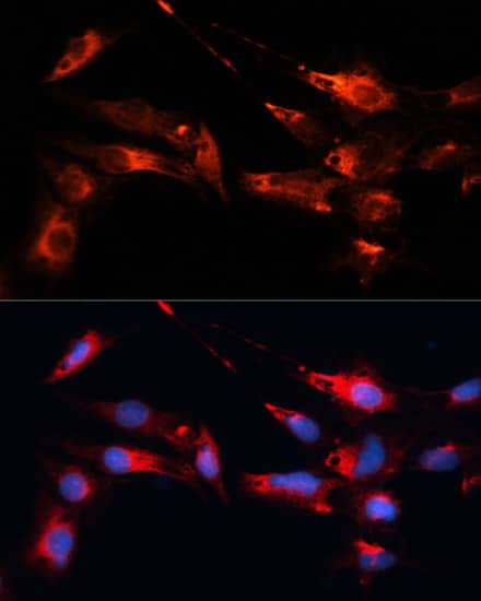 Immunocytochemistry/ Immunofluorescence: MAP1B Antibody - BSA Free [NBP3-04801] - Immunofluorescence analysis of C6 cells using MAP1B antibody (A3305) at dilution of 1:100. Blue: DAPI for nuclear staining.