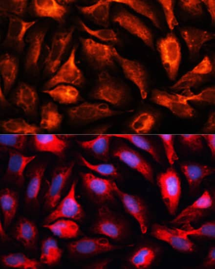 Immunocytochemistry/ Immunofluorescence: MAP1B Antibody - BSA Free [NBP3-04801] - Immunofluorescence analysis of U2OS cells using MAP1B antibody (A3305) at dilution of 1:100. Blue: DAPI for nuclear staining.