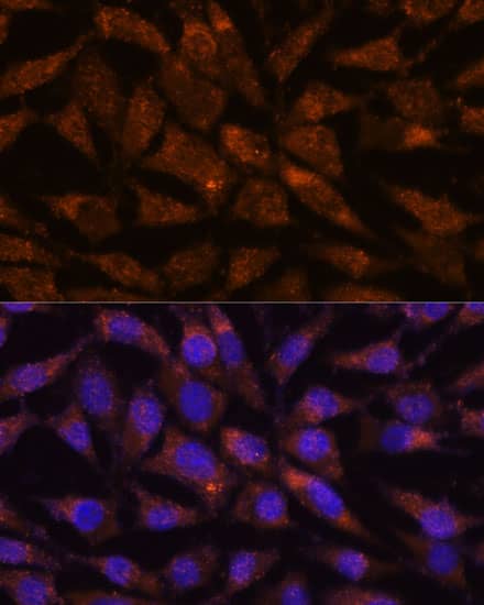 Immunocytochemistry/ Immunofluorescence LMAN2 Antibody - Azide and BSA Free