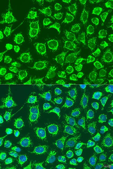Immunocytochemistry/ Immunofluorescence GYPB Antibody - BSA Free