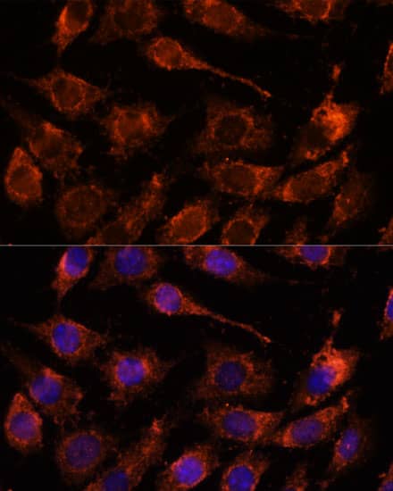 Immunocytochemistry/ Immunofluorescence: GPRASP1 Antibody - Azide and BSA Free [NBP3-04829] - Immunofluorescence analysis of L929 cells using GPRASP1 Rabbit pAb (A16090) at dilution of 1:100. Secondary antibody: Cy3 Goat Anti-Rabbit IgG (H+L) (AS007) at 1:500 dilution. Blue: DAPI for nuclear staining.