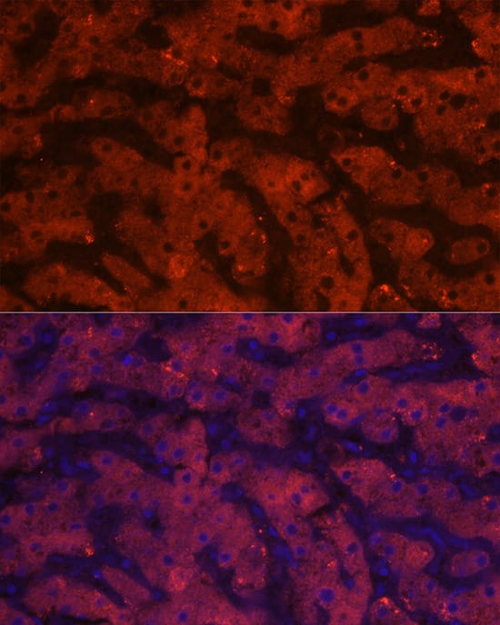 Immunocytochemistry/ Immunofluorescence: HSD17B13 Antibody - Azide and BSA Free [HSD17B13] - Immunofluorescence analysis of paraffin-embedded human liver using HSD17B13 Rabbit pAb  at dilution of 1:20 (40x lens). Secondary antibody: Cy3-conjugated Goat anti-Rabbit IgG (H+L)  at 1:500 dilution. Blue: DAPI for nuclear staining.