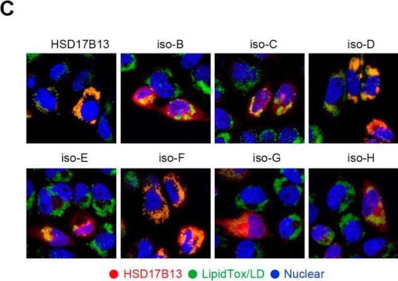 HSD17B13 promotes the accumulation of intracellular lipid droplets and causes hepatocyte injury. (A) mRNAs in palmitate-treated cells were measured by qRT-PCR. (B) Schematic of full-length or truncated transcripts of HSD17B13. (C) Representative confocal images of L02 cells transfected with His-tagged HSD17B13 transcripts (red) and LDs (green) after being induced by OA (400 μM) for 24 h. Nuclei were labeled with DAPI (blue). (D,E) Representative immunofluorescence staining images for LDs (red) (D) and relative intracellular Nile red positive areas were quantified (E) in L02 cells transfected with HSD17B13 transcripts after OA (400 μM) challenge for 24 h, the slides were counterstained with DAPI. (F) Schematic of the experimental design for investigating the effect of HSD17B13 on intracellular TGs, the contents of TGs were detected and the half-life of TGs was calculated. (G,H) Levels of ALT (G) and AST (H) in supernatants and cell lysates of Huh7 cells transfected with the plasmids of HSD17B13 for 24 h. (I) mRNA of proinflammatory markers in L02 cells transfected with plasmids of HSD17B13 for 24 h. Results are expressed as mean +/- SEM. OA, oleic acid; LDs, lipid droplets; TGs, triglycerides; PLIN2, perilipin 2; ALT, alanine transaminase; AST, aspartate transaminase; TGF-beta 1, transforming growth factor-beta 1; IL-6, interleukin 6; CXCL3, C-X-C motif chemokine ligand 3. Image collected and cropped by CiteAb from the following open publication (//pubmed.ncbi.nlm.nih.gov/35628360), licensed under a CC-BY license. Not internally tested by Novus Biologicals.