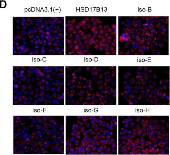 HSD17B13 promotes the accumulation of intracellular lipid droplets and causes hepatocyte injury. (A) mRNAs in palmitate-treated cells were measured by qRT-PCR. (B) Schematic of full-length or truncated transcripts of HSD17B13. (C) Representative confocal images of L02 cells transfected with His-tagged HSD17B13 transcripts (red) and LDs (green) after being induced by OA (400 μM) for 24 h. Nuclei were labeled with DAPI (blue). (D,E) Representative immunofluorescence staining images for LDs (red) (D) and relative intracellular Nile red positive areas were quantified (E) in L02 cells transfected with HSD17B13 transcripts after OA (400 μM) challenge for 24 h, the slides were counterstained with DAPI. (F) Schematic of the experimental design for investigating the effect of HSD17B13 on intracellular TGs, the contents of TGs were detected and the half-life of TGs was calculated. (G,H) Levels of ALT (G) and AST (H) in supernatants and cell lysates of Huh7 cells transfected with the plasmids of HSD17B13 for 24 h. (I) mRNA of proinflammatory markers in L02 cells transfected with plasmids of HSD17B13 for 24 h. Results are expressed as mean +/- SEM. OA, oleic acid; LDs, lipid droplets; TGs, triglycerides; PLIN2, perilipin 2; ALT, alanine transaminase; AST, aspartate transaminase; TGF-beta 1, transforming growth factor-beta 1; IL-6, interleukin 6; CXCL3, C-X-C motif chemokine ligand 3. Image collected and cropped by CiteAb from the following open publication (//pubmed.ncbi.nlm.nih.gov/35628360), licensed under a CC-BY license. Not internally tested by Novus Biologicals.