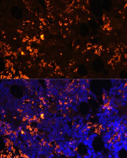 Immunocytochemistry/ Immunofluorescence: GPR55 Antibody - Azide and BSA Free [NBP3-04847] - Immunofluorescence analysis of paraffin-embedded rat bone marrow using GPR55 Rabbit pAb (A12890) at dilution of 1:100. Secondary antibody: Cy3 Goat Anti-Rabbit IgG (H+L) (AS007) at 1:500 dilution. Blue: DAPI for nuclear staining.