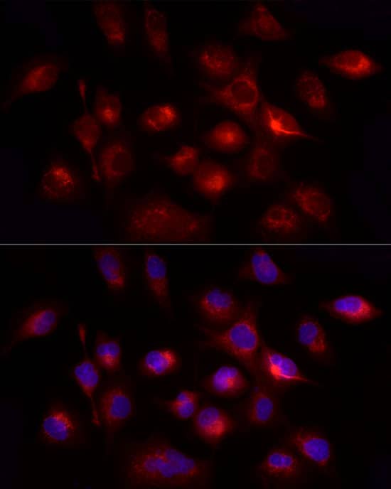 Immunocytochemistry/ Immunofluorescence GHRH Antibody - Azide and BSA Free