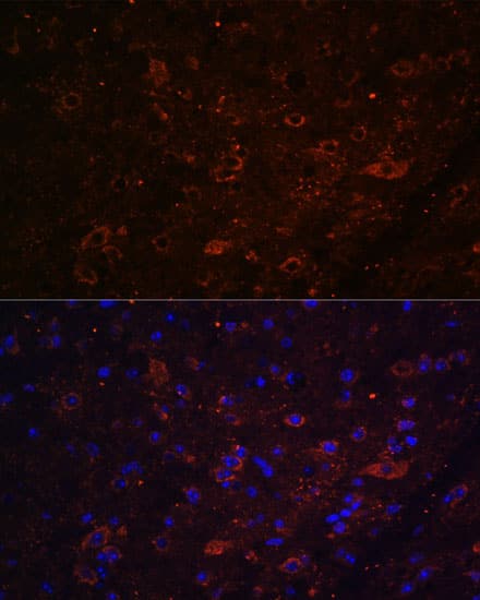Immunocytochemistry/ Immunofluorescence: FSTL5 Antibody - Azide and BSA Free [NBP3-04852] - Immunofluorescence analysis of paraffin-embedded mouse brain using FSTL5 Rabbit pAb (A16553) at dilution of 1:100. Secondary antibody: Cy3 Goat Anti-Rabbit IgG (H+L) (AS007) at 1:500 dilution. Blue: DAPI for nuclear staining.