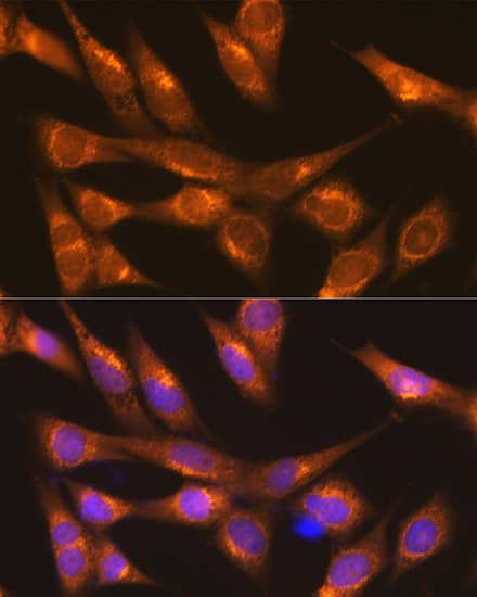 Immunocytochemistry/ Immunofluorescence: LMAN1 Antibody - Azide and BSA Free [NBP3-04910] - Immunofluorescence analysis of NIH-3T3 cells using LMAN1 Rabbit pAb (A10440) at dilution of 1:100 (40x lens). Secondary antibody: Cy3 Goat Anti-Rabbit IgG (H+L) (AS007) at 1:500 dilution. Blue: DAPI for nuclear staining.