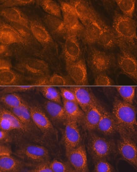 Immunocytochemistry/ Immunofluorescence: LMAN1 Antibody - Azide and BSA Free [NBP3-04910] - Immunofluorescence analysis of C6 cells using LMAN1 Rabbit pAb (A10440) at dilution of 1:100 (40x lens). Secondary antibody: Cy3 Goat Anti-Rabbit IgG (H+L) (AS007) at 1:500 dilution. Blue: DAPI for nuclear staining.