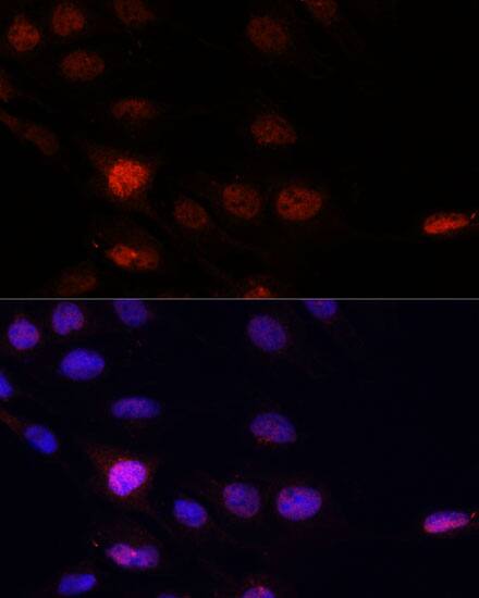 Immunocytochemistry/ Immunofluorescence: KLHL8 Antibody - Azide and BSA Free [NBP3-04914] - Immunofluorescence analysis of C6 cells using KLHL8 Rabbit pAb (A14917) at dilution of 1:100. Secondary antibody: Cy3 Goat Anti-Rabbit IgG (H+L) (AS007) at 1:500 dilution. Blue: DAPI for nuclear staining.