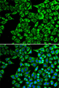 Immunocytochemistry/ Immunofluorescence LIPC Antibody - BSA Free