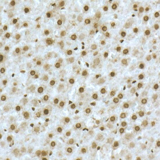 Immunohistochemistry: TOX Antibody - Azide and BSA Free [TOX] - Immunohistochemistry analysis of paraffin-embedded Rat liver using TOX Rabbit pAb  at dilution of 1:50 (40x lens). High pressure antigen retrieval performed with 0.01M Citrate Bufferr (pH 6.0) prior to IHC staining.