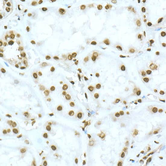 Immunohistochemistry: TOX Antibody - Azide and BSA Free [TOX] - Immunohistochemistry analysis of paraffin-embedded Human kidney using TOX Rabbit pAb  at dilution of 1:50 (40x lens). High pressure antigen retrieval performed with 0.01M Citrate Bufferr (pH 6.0) prior to IHC staining.