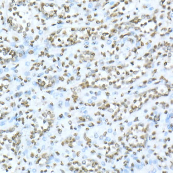 Immunohistochemistry TOX Antibody - Azide and BSA Free