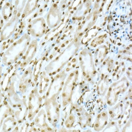 Immunohistochemistry TOX Antibody - Azide and BSA Free