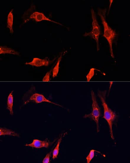 Immunocytochemistry/ Immunofluorescence: DNASE1 Antibody - Azide and BSA Free [NBP3-04947] - Immunofluorescence analysis of C6 cells using DNASE1 Rabbit pAb (A14531) at dilution of 1:100 (40x lens). Secondary antibody: Cy3 Goat Anti-Rabbit IgG (H+L) (AS007) at 1:500 dilution. Blue: DAPI for nuclear staining.