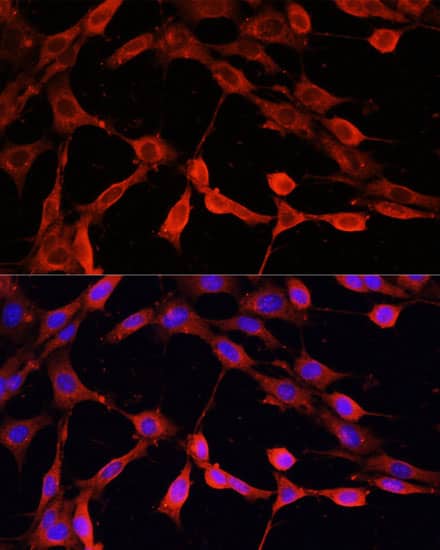 Immunocytochemistry/ Immunofluorescence: DNASE1 Antibody - Azide and BSA Free [NBP3-04947] - Immunofluorescence analysis of NIH-3T3 cells using DNASE1 Rabbit pAb (A14531) at dilution of 1:100 (40x lens). Secondary antibody: Cy3 Goat Anti-Rabbit IgG (H+L) (AS007) at 1:500 dilution. Blue: DAPI for nuclear staining.