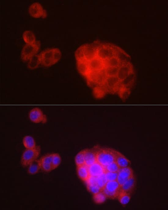 Immunocytochemistry/ Immunofluorescence: METTL7A Antibody - BSA Free [METTL7A] - Immunofluorescence analysis of HepG2 cells using METTL7A Rabbit pAb  at dilution of 1:100 (40x lens). Secondary antibody: Cy3 Goat Anti-Rabbit IgG (H+L)  at 1:500 dilution. Blue: DAPI for nuclear staining.
