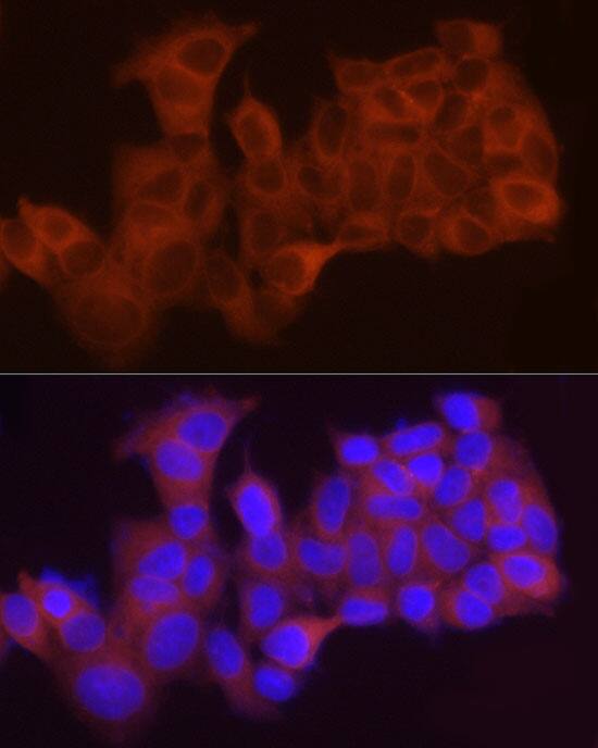 Immunocytochemistry/ Immunofluorescence: LPCAT1 Antibody - BSA Free [NBP3-04963] - Immunofluorescence analysis of MCF7 cells using LPCAT1 Rabbit pAb (A4987) at dilution of 1:50 (40x lens). Blue: DAPI for nuclear staining.