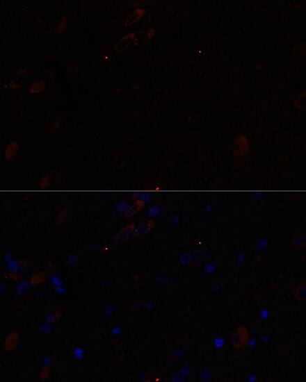 Immunocytochemistry/ Immunofluorescence: KIF17 Antibody - Azide and BSA Free [KIF17] - Immunofluorescence analysis of paraffin-embedded rat brain using KIF17 Rabbit pAb  at dilution of 1:100. Secondary antibody: Cy3 Goat Anti-Rabbit IgG (H+L)  at 1:500 dilution. Blue: DAPI for nuclear staining.