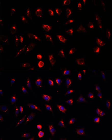 Immunocytochemistry/ Immunofluorescence: GALNT2 Antibody - BSA Free [GALNT2] - Immunofluorescence analysis of L929 cells using GALNT2 Rabbit pAb  at dilution of 1:100. Secondary antibody: Cy3-conjugated Goat anti-Rabbit IgG (H+L)  at 1:500 dilution. Blue: DAPI for nuclear staining.