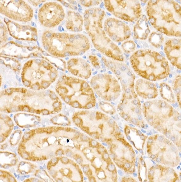 Immunohistochemistry: GALNT2 Antibody - BSA Free [GALNT2] - Immunohistochemistry analysis of paraffin-embedded Rat kidney using GALNT2 Rabbit pAb  at dilution of 1:400 (40x lens). High pressure antigen retrieval performed with 0.01M Citrate Bufferr (pH 6.0) prior to IHC staining.