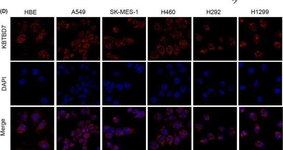 Immunocytochemistry/ Immunofluorescence KBTBD7 Antibody - BSA Free