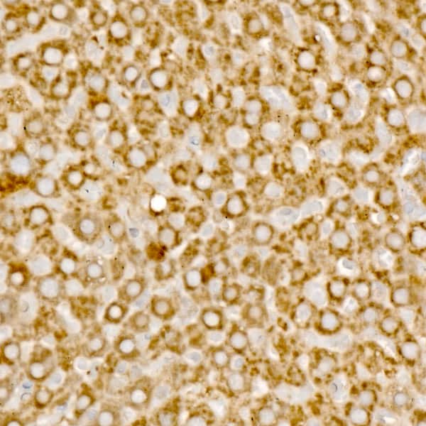 Immunohistochemistry: MCCC1 Antibody - BSA Free [MCCC1] - Immunohistochemistry analysis of paraffin-embedded rat liver using MCCC1 Rabbit pAb  at dilution of 1:100 (40x lens).Perform high pressure antigen retrieval with 10 mM citrate buffer pH 6.0 before commencing with IHC staining protocol.