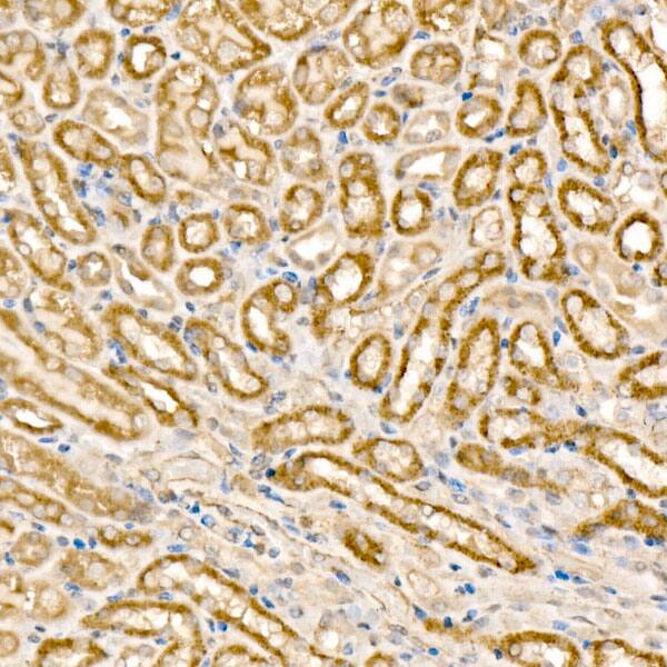 Immunohistochemistry: MCCC1 Antibody - BSA Free [MCCC1] - Immunohistochemistry analysis of paraffin-embedded mouse kidney using MCCC1 Rabbit pAb  at dilution of 1:100 (40x lens).Perform high pressure antigen retrieval with 10 mM citrate buffer pH 6.0 before commencing with IHC staining protocol.