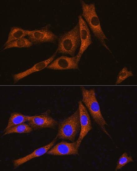 Immunocytochemistry/ Immunofluorescence: GNAT3 Antibody - Azide and BSA Free [NBP3-05122] - Immunofluorescence analysis of NIH/3T3 cells using GNAT3 Rabbit pAb (A15982) at dilution of 1:100. Secondary antibody: Cy3 Goat Anti-Rabbit IgG (H+L) (AS007) at 1:500 dilution. Blue: DAPI for nuclear staining.