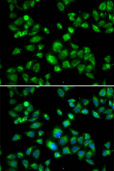 Immunocytochemistry/ Immunofluorescence: MBTPS1 Antibody - Azide and BSA Free [MBTPS1] - Immunofluorescence analysis of U2OS cells using MBTPS1 Rabbit pAb . Secondary antibody: Cy3-conjugated Goat anti-Rabbit IgG (H+L)  at 1:500 dilution. Blue: DAPI for nuclear staining.