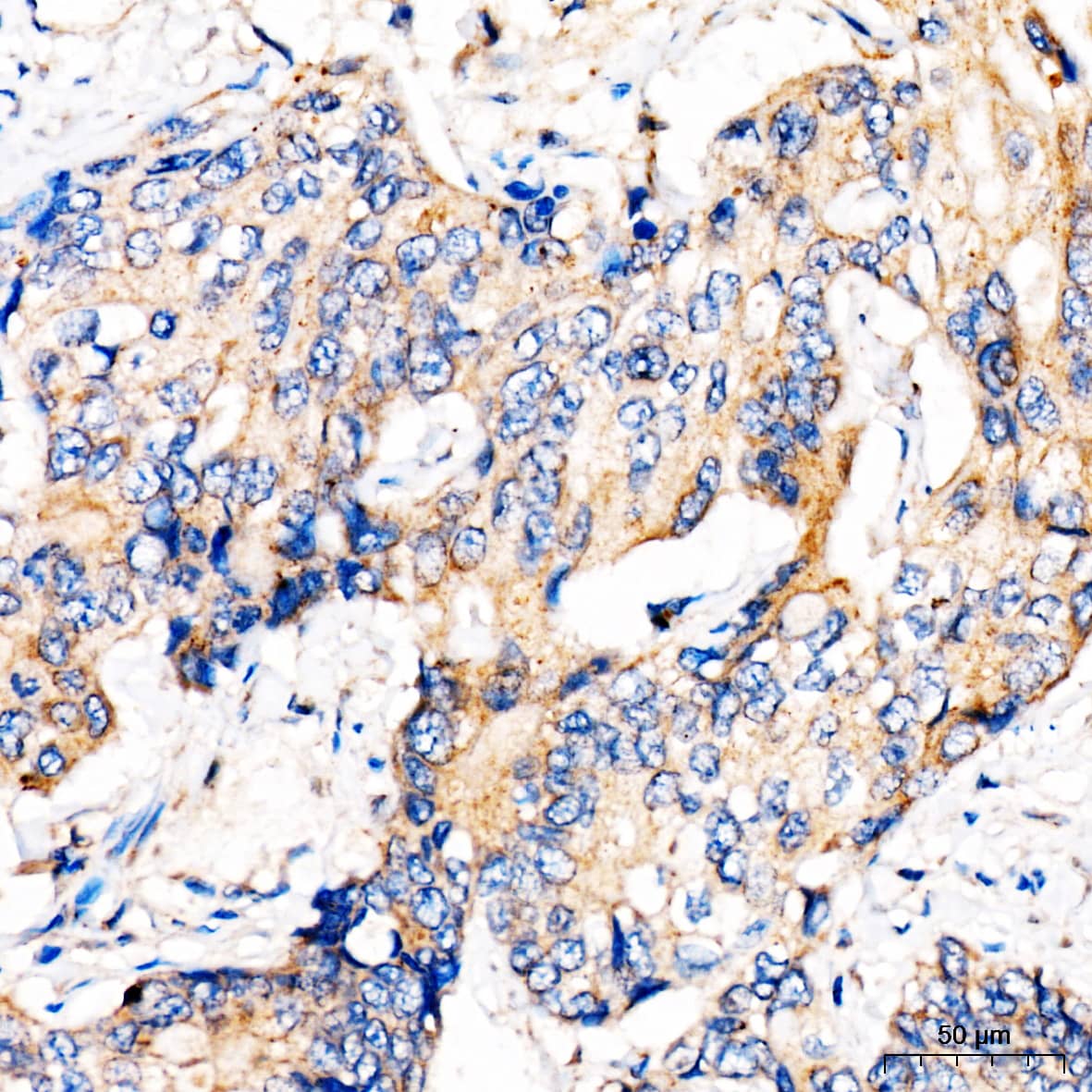 Immunohistochemistry MBTPS1 Antibody - Azide and BSA Free