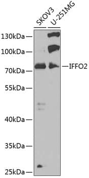 Western Blot: IFFO2 Antibody - BSA Free [NBP3-05222] - Western blot analysis of extracts of various cell lines, using IFFO2 antibody (A7541) at 1:1000 dilution.Secondary antibody: HRP Goat Anti-Rabbit IgG (H+L) (AS014) at 1:10000 dilution.Lysates/proteins: 25μg per lane.Blocking buffer: 3% nonfat dry milk in TBST.Detection: ECL Basic Kit (RM00020).Exposure time: 90s.