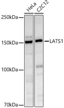 Western Blot: LATS1 Antibody - Azide and BSA Free [LATS1] - Western blot analysis of various lysates using LATS1 Rabbit pAb  at 1:1000 dilution.Secondary antibody: HRP-conjugated Goat anti-Rabbit IgG (H+L)  at 1:10000 dilution.Lysates/proteins: 25ug per lane.Blocking buffer: 3% nonfat dry milk in TBST.Detection: ECL Basic Kit .Exposure time: 10s.