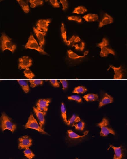 Immunocytochemistry/ Immunofluorescence: OBSCN Antibody - Azide and BSA Free [NBP3-05247] - Immunofluorescence analysis of paraffin-embedded mouse heart using OBSCN Rabbit pAb  at dilution of 1:100. Secondary antibody: Cy3 Goat Anti-Rabbit IgG (H+L)  at 1:500 dilution. Blue: DAPI for nuclear staining.