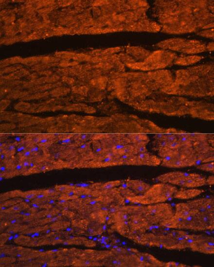 Immunocytochemistry/ Immunofluorescence: OBSCN Antibody - Azide and BSA Free [NBP3-05247] - Immunofluorescence analysis of paraffin-embedded rat heart using OBSCN Rabbit pAb  at dilution of 1:100. Secondary antibody: Cy3 Goat Anti-Rabbit IgG (H+L)  at 1:500 dilution. Blue: DAPI for nuclear staining.