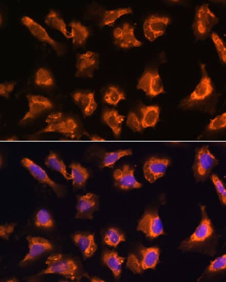 Immunocytochemistry/ Immunofluorescence OBSCN Antibody - Azide and BSA Free