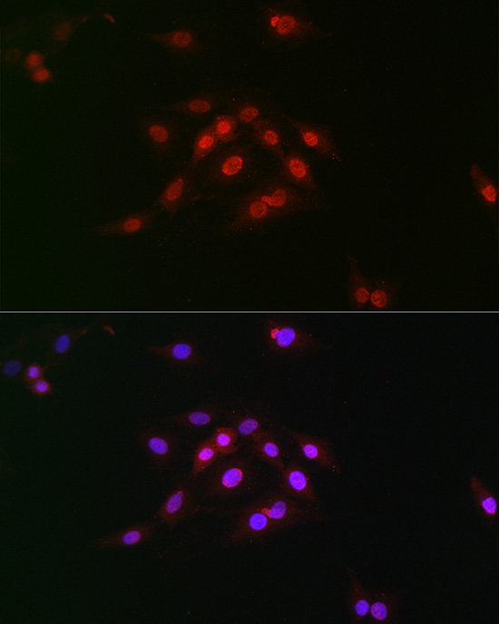 Immunocytochemistry/ Immunofluorescence: Cyclin E1 [p Thr395] Antibody - BSA Free [Cyclin E1] - Immunofluorescence analysis of C6 cells using Cyclin E1 Rabbit pAb  at dilution of 1:100 (40x lens). Blue: DAPI for nuclear staining.