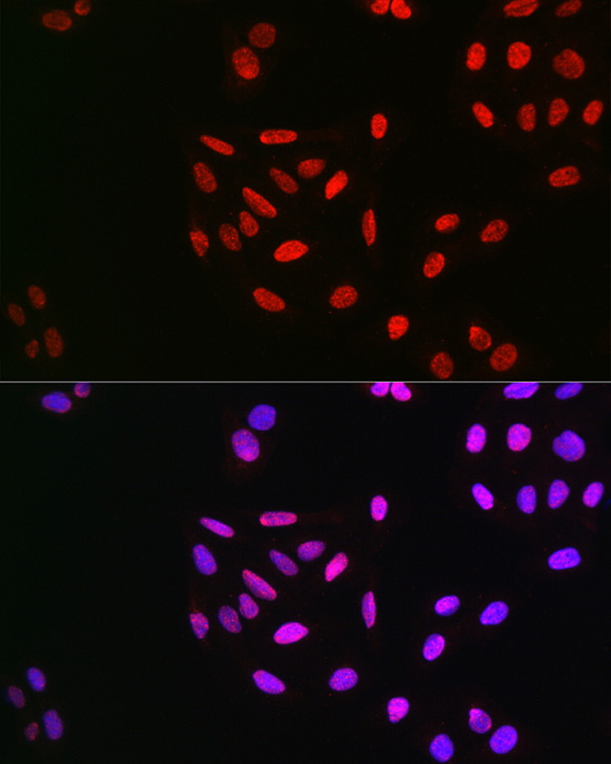 Immunocytochemistry/ Immunofluorescence: Cyclin E1 [p Thr395] Antibody - BSA Free [Cyclin E1] - Immunofluorescence analysis of U2OS cells using Cyclin E1 Rabbit pAb  at dilution of 1:100 (40x lens). Blue: DAPI for nuclear staining.