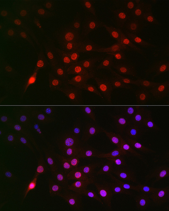 Immunocytochemistry/ Immunofluorescence: Cyclin E1 [p Thr395] Antibody - BSA Free [Cyclin E1] - Immunofluorescence analysis of NIH/3T3 cells using Cyclin E1 Rabbit pAb  at dilution of 1:100 (40x lens). Blue: DAPI for nuclear staining.