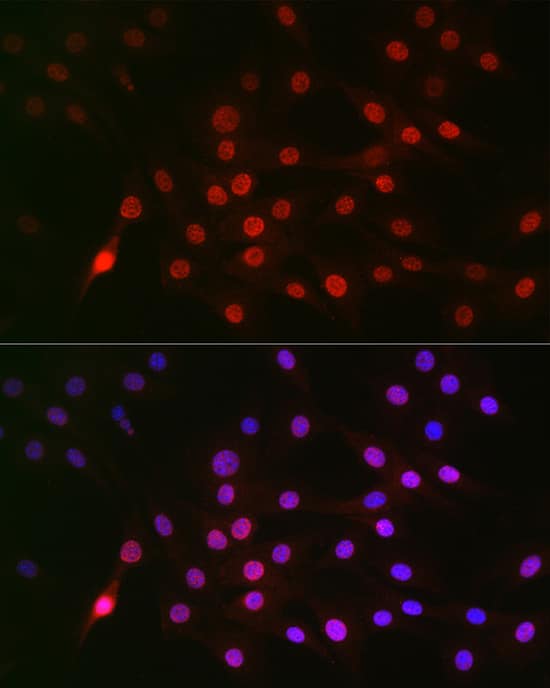 Immunocytochemistry/ Immunofluorescence: Cyclin E1 [p Thr395] Antibody - BSA Free [NBP3-05378] - Immunofluorescence analysis of NIH/3T3 cells using Cyclin E1 Rabbit pAb  at dilution of 1:100 (40x lens). Blue: DAPI for nuclear staining.