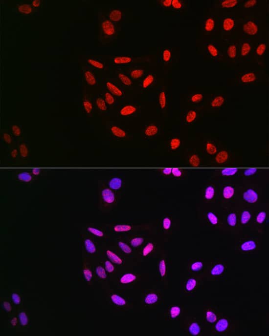 Immunocytochemistry/ Immunofluorescence: Cyclin E1 [p Thr395] Antibody - BSA Free [NBP3-05378] - Immunofluorescence analysis of U2OS cells using Cyclin E1 Rabbit pAb  at dilution of 1:100 (40x lens). Blue: DAPI for nuclear staining.