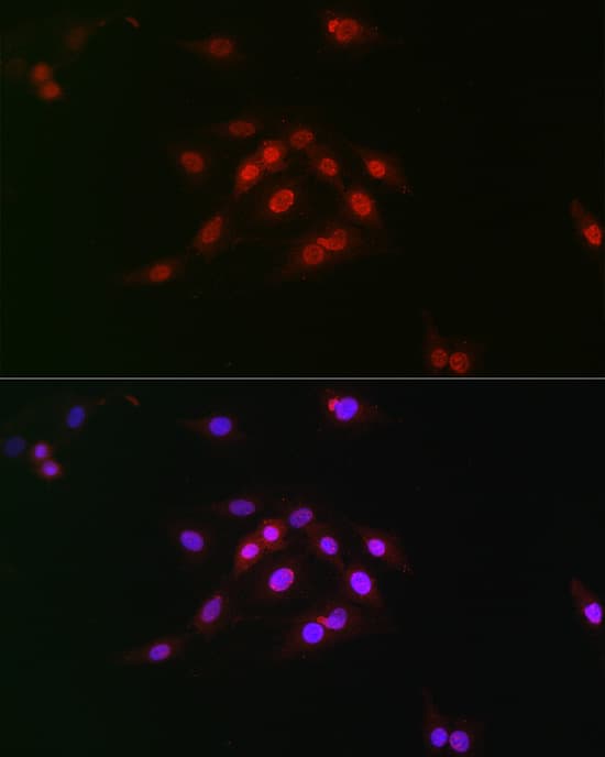 Immunocytochemistry/ Immunofluorescence: Cyclin E1 [p Thr395] Antibody - BSA Free [NBP3-05378] - Immunofluorescence analysis of C6 cells using Cyclin E1 Rabbit pAb  at dilution of 1:100 (40x lens). Blue: DAPI for nuclear staining.