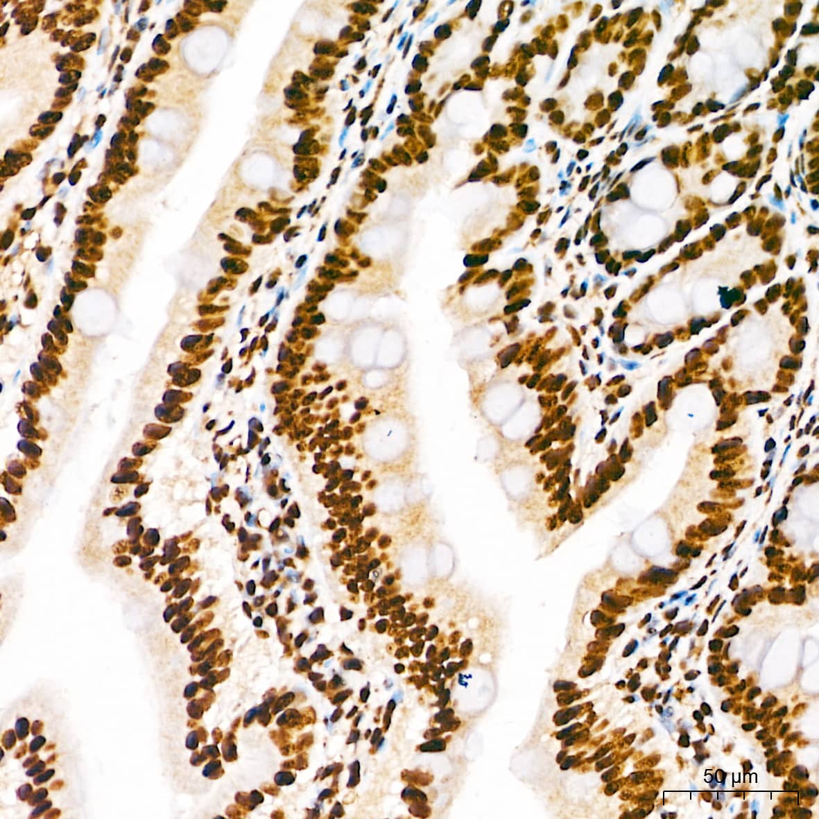 Immunohistochemistry: Elk-1 [p Ser383] Antibody - BSA Free [Elk-1] - Immunohistochemistry analysis of paraffin-embedded Rat intestine tissue using Elk-1 Rabbit pAb  at a dilution of 1:200 (40x lens). High pressure antigen retrieval performed with 0.01M Citrate Buffer(pH 6.0) prior to IHC staining.