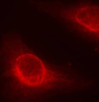 Immunocytochemistry/ Immunofluorescence: Cofilin [p Ser3] Antibody - Azide and BSA Free [Cofilin] - Immunofluorescence analysis of methanol-fixed HeLa cells using Cofilin Rabbit pAb .