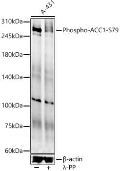 Western Blot: Acetyl-CoA Carboxylase alpha/ACACA [p Ser79] Antibody - Azide and BSA Free [Acetyl-CoA Carboxylase alpha/ACACA] - Western blot analysis of lysates from A-431 cells, using Acetyl-CoA Carboxylase alpha/ACACA Rabbit pAb  at 1:700 dilution. A-431 cells were treated by lambda-PP mixed solution (1ul) at 30C for 30 minutes.Secondary antibody: HRP-conjugated Goat anti-Rabbit IgG (H+L)  at 1:10000 dilution.Lysates/proteins: 25ug per lane.Blocking buffer: 3% nonfat dry milk in TBST.Detection: ECL Enhanced Kit .Exposure time: 90s.