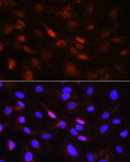 Immunocytochemistry/ Immunofluorescence: Jak1 [p Tyr1022, p Tyr1023] Antibody - BSA Free [Jak1] - Immunofluorescence analysis of NIH/3T3 cells using Jak1 Rabbit pAb  at dilution of 1:100. Blue: DAPI for nuclear staining.