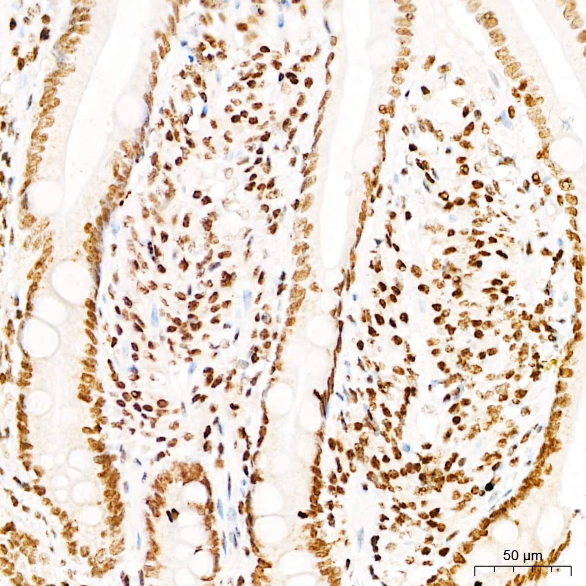 Immunohistochemistry: DNA-PKcs [p Ser2056] Antibody - Azide and BSA Free [DNA-PKcs] - Immunohistochemistry analysis of paraffin-embedded Human small intestine tissue using DNA-PKcs Rabbit pAb  at a dilution of  1:300 (40x lens). High pressure antigen retrieval was performed with 0.01 M citrate buffer (pH 6.0) prior to IHC staining.